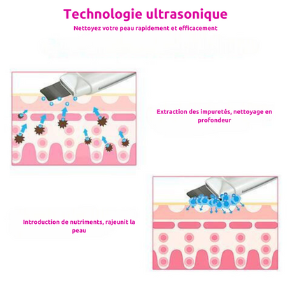 DermiCleanse - Appareil d’extraction des points noirs